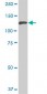 NEK9 Antibody (monoclonal) (M01)