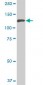 NEK9 Antibody (monoclonal) (M01)