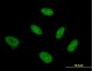 NFYB Antibody (monoclonal) (M03)