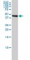 NJMU-R1 Antibody (monoclonal) (M01)