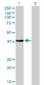 NKX2-5 Antibody (monoclonal) (M01)
