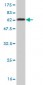 NKX2-5 Antibody (monoclonal) (M02)