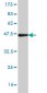 NKX3-1 Antibody (monoclonal) (M02)