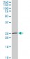 NKX3-1 Antibody (monoclonal) (M02)