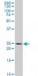 NKX3-1 Antibody (monoclonal) (M02)