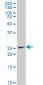 NKX3-1 Antibody (monoclonal) (M02)