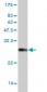NKX3-1 Antibody (monoclonal) (M03)