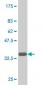 NKX6-1 Antibody (monoclonal) (M01)