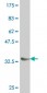 NKX6-1 Antibody (monoclonal) (M02)