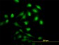 NME1 Antibody (monoclonal) (M01)