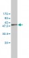 NME1 Antibody (monoclonal) (M01)