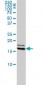 NME1 Antibody (monoclonal) (M01)