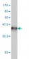 NME1 Antibody (monoclonal) (M02)