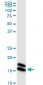 NME1 Antibody (monoclonal) (M02)