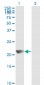 NME1 Antibody (monoclonal) (M02)