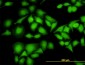 NME1 Antibody (monoclonal) (M02)