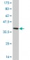 NME2 Antibody (monoclonal) (M06)