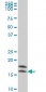 NME2 Antibody (monoclonal) (M06)