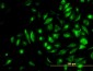 NME2 Antibody (monoclonal) (M06)