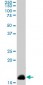 NME2 Antibody (monoclonal) (M08)