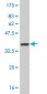 NME2 Antibody (monoclonal) (M09)