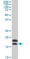 NME2 Antibody (monoclonal) (M09)