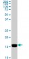 NME2 Antibody (monoclonal) (M09)