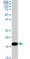 NME2 Antibody (monoclonal) (M09)