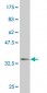 NME2 Antibody (monoclonal) (M11)