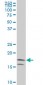 NME2 Antibody (monoclonal) (M11)