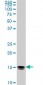 NME2 Antibody (monoclonal) (M11)