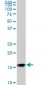 NME2 Antibody (monoclonal) (M11)