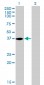 NMI Antibody (monoclonal) (M01)