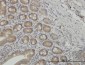 NMI Antibody (monoclonal) (M03)