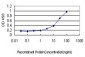 NODAL Antibody (monoclonal) (M05)