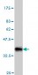 NODAL Antibody (monoclonal) (M05)