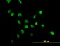 NPM1 Antibody (monoclonal) (M01)