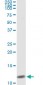 NPPB Antibody (monoclonal) (M01)