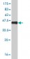 NPPB Antibody (monoclonal) (M01)