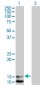 NPPB Antibody (monoclonal) (M01)