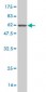 NQO1 Antibody (monoclonal) (M01)