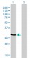 NQO1 Antibody (monoclonal) (M01)