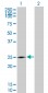 NQO2 Antibody (monoclonal) (M01)