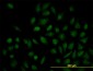 NR1H4 Antibody (monoclonal) (M02)