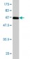 NR2E3 Antibody (monoclonal) (M01)