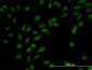 NR3C1 Antibody (monoclonal) (M01)