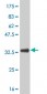 NR3C1 Antibody (monoclonal) (M01)