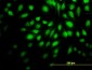 NR4A2 Antibody (monoclonal) (M02)