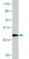 NR4A2 Antibody (monoclonal) (M02)