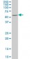 NR4A2 Antibody (monoclonal) (M02)